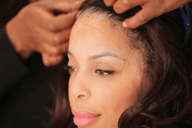 How To Remove a Lace Wig Without Damaging Edges